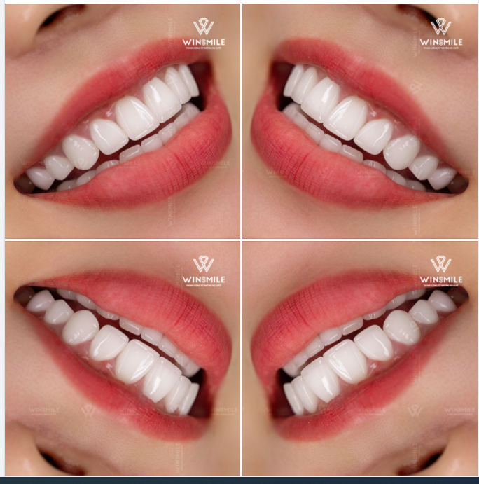 WIN SMILE - LỰA CHỌN TỐI ƯU, CHẤT LƯỢNG HÀNG ĐẦU