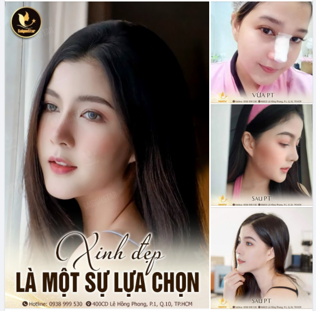 XINH ĐẸP LÀ MỘT SỰ LỰA CHỌN