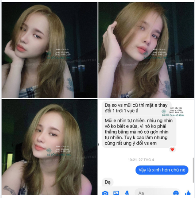 1 CHIẾC FEEDBACK DỄ THƯƠNG VỚI DÁNG MŨI TỰ NHIÊN ĐỘC QUYỀN TRUNG TÂM BS KHẢI