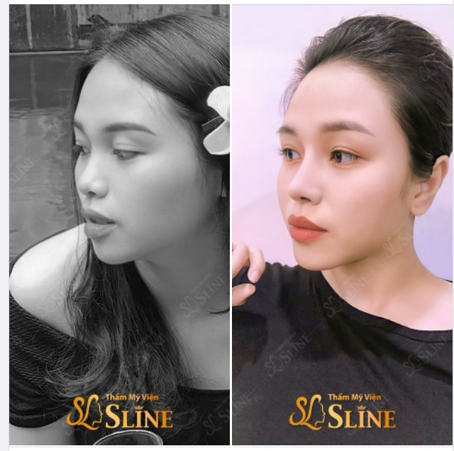 1 CHIẾC MŨI làm thay đổi cả giao diện...