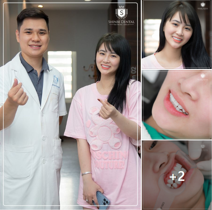 18 răng sứ Veneer Emax đã biến đổi hoàn toàn nụ cười của nữ khách hàng Shinbi