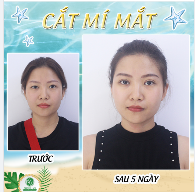 2 MÍ ĐỀU ĐẸP GIÚP KHUÔN MẶT SÁNG VÀ TRẺ TRUNG