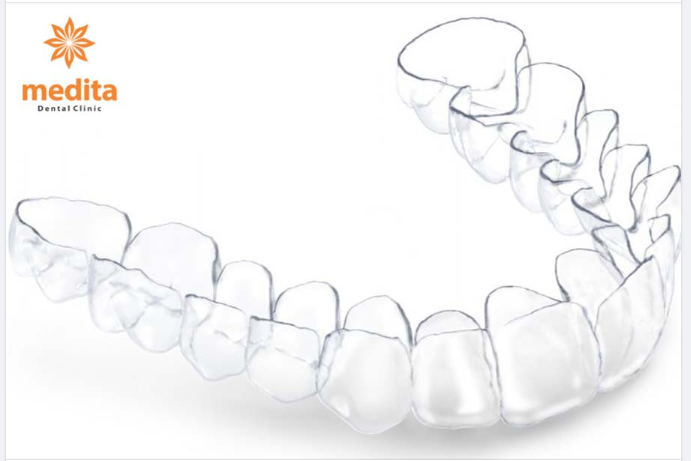 3 CÁCH LÀM SẠCH GIÚP KHAY NIỀNG LUÔN TRẮNG SÁNG