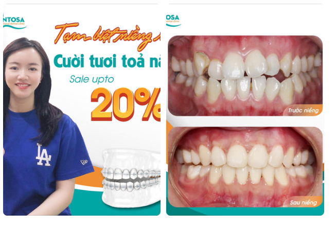 3 NĂM THANH XUÂN ĐỔI LẤY NỤ CƯỜI RẠNG RỠ TRỌN ĐỜI