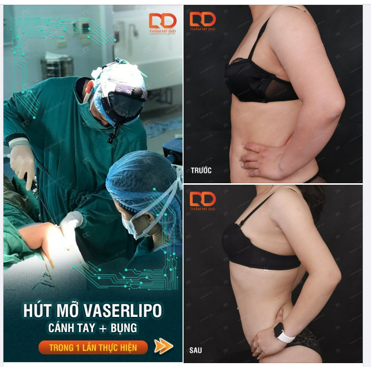 60 PHÚT THỰC HIỆN = 1 NĂM TẬP THỂ DỤC