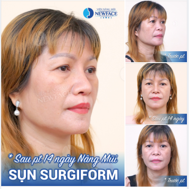 Ai cũng có quyền “tỏa sáng” theo cách riêng mà phải không