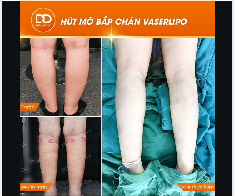 Album bao gồm hình ảnh trước sau thực tế các khách hàng thực hiện dịch vụ tại DrD.