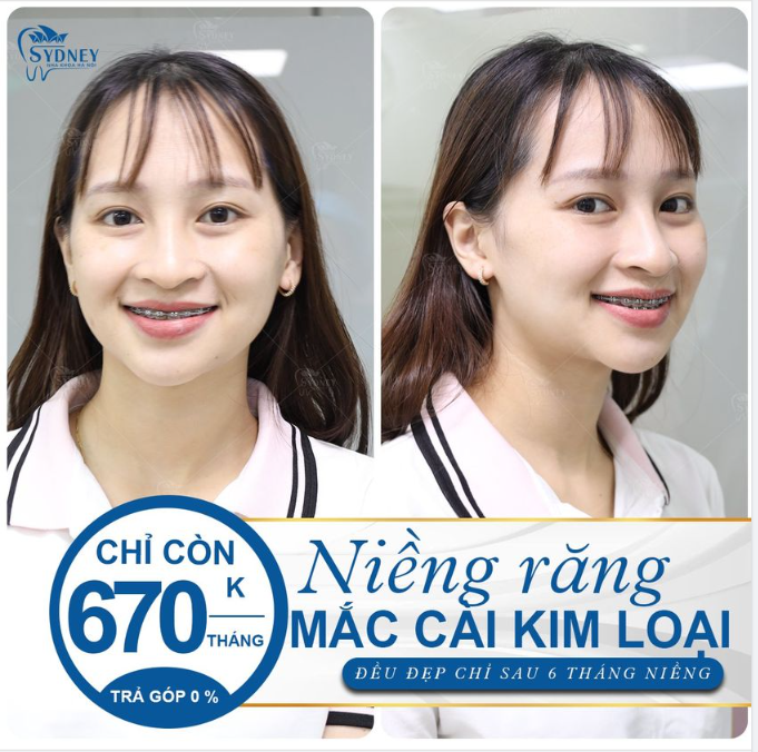 BẠN ĐÃ TỰ TIN HƠN NHIỀU CHƯA????