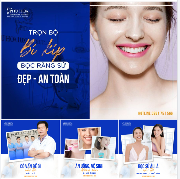 BÍ KÍP BỌC RĂNG SỨ ĐẸP, AN TOÀN