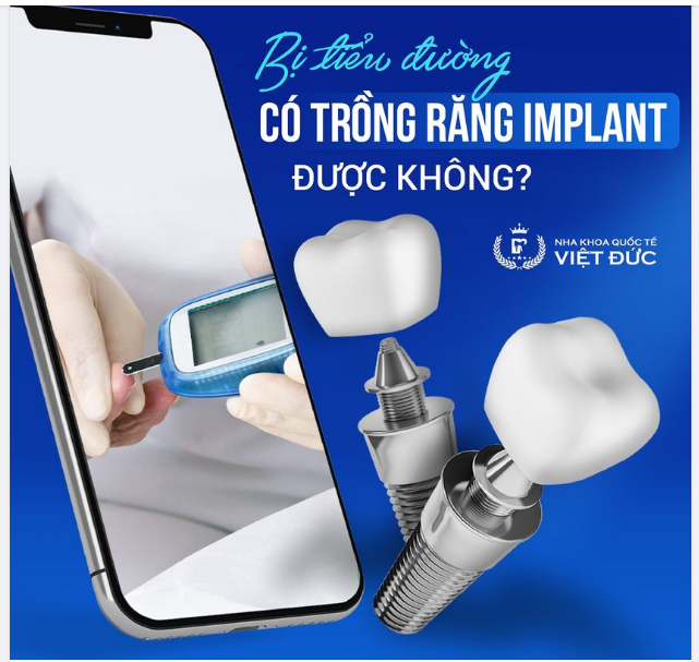 BỊ TIỂU ĐƯỜNG CÓ TRỒNG ĐƯỢC IMPLANT