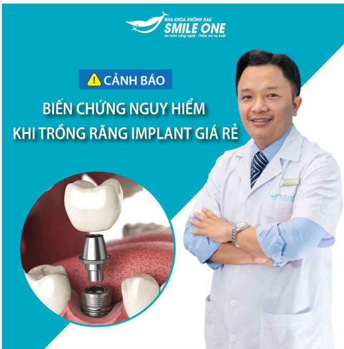 BIẾN CHỨNG NGUY HIỂM KHI TRỒNG RĂNG GIÁ RẺ