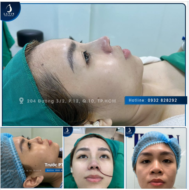 Biến hình siêu mượt cùng latin
