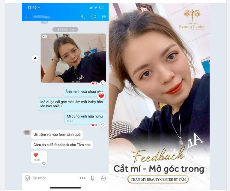 “Bộ đôi khuynh đảo” Cắt mí - Mở góc trong tại TMV Tấm chưa bao giờ làm chị em thất vọng