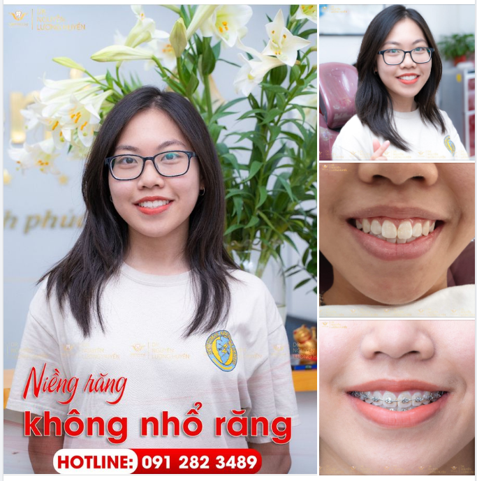 BỎ NGOÀI TAI LỜI TRÊU CHỌC "HUYỀN HÔ" "RĂNG SẮT"