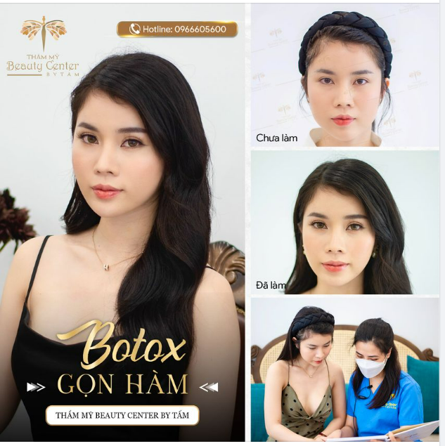 BOTOX GỌN HÀM - GIẢI PHÁP  GỌT MẶT KHÔNG CẦN DAO KÉO