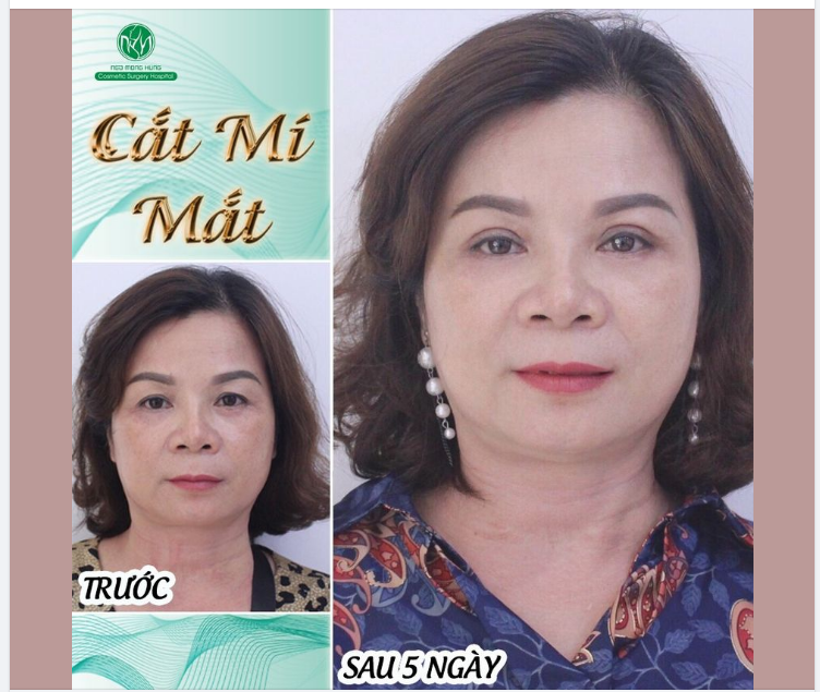 CẢ GIA ĐÌNH ĐỀU LÀM ĐẸP TẠI BỆNH VIỆN