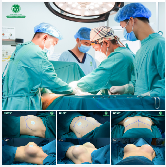 CA NÂNG NGỰC CUỐI NGÀY