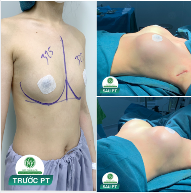 CÁI KẾT ĐẸP CHO CÔ GÁI TRẺ 21 TUỔI