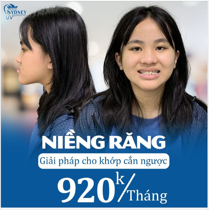 CẢI THIỆN TÌNH TRẠNG MÓM CÙNG MẮC CÀI PHA LÊ