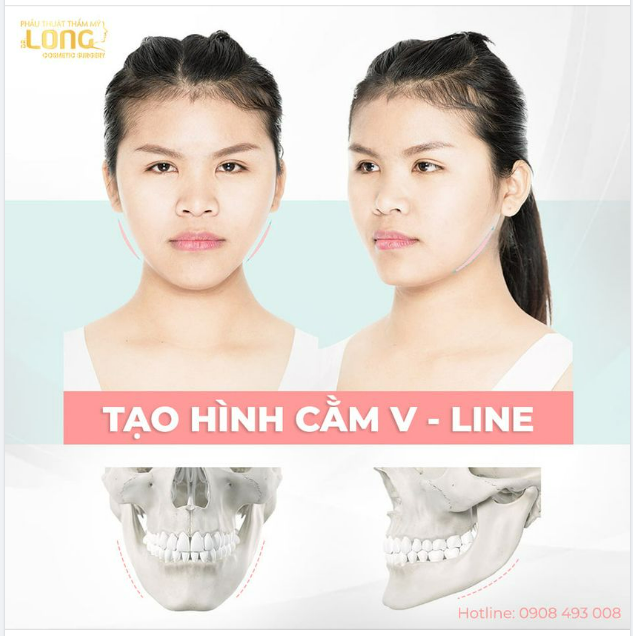 CẰM CHUẨN XINH - NHAN SẮC LUNG LINH