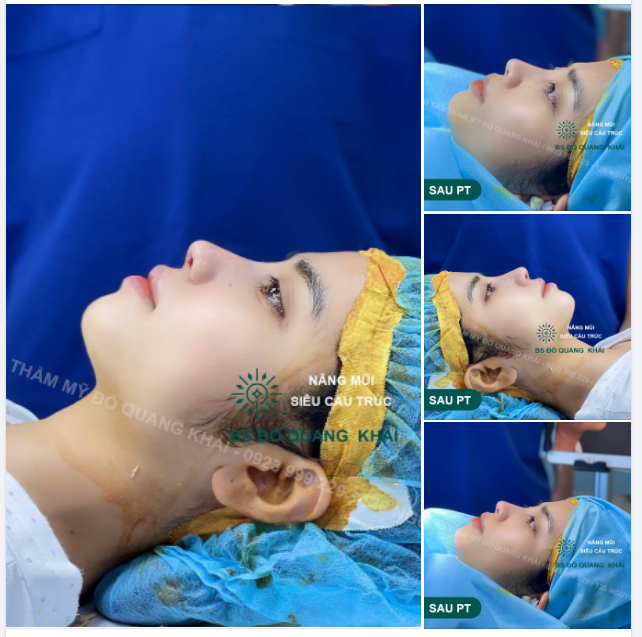CÀNG NGẮM CÀNG MÊ - MŨI ĐẸP KHÔNG THỂ CHÊ!