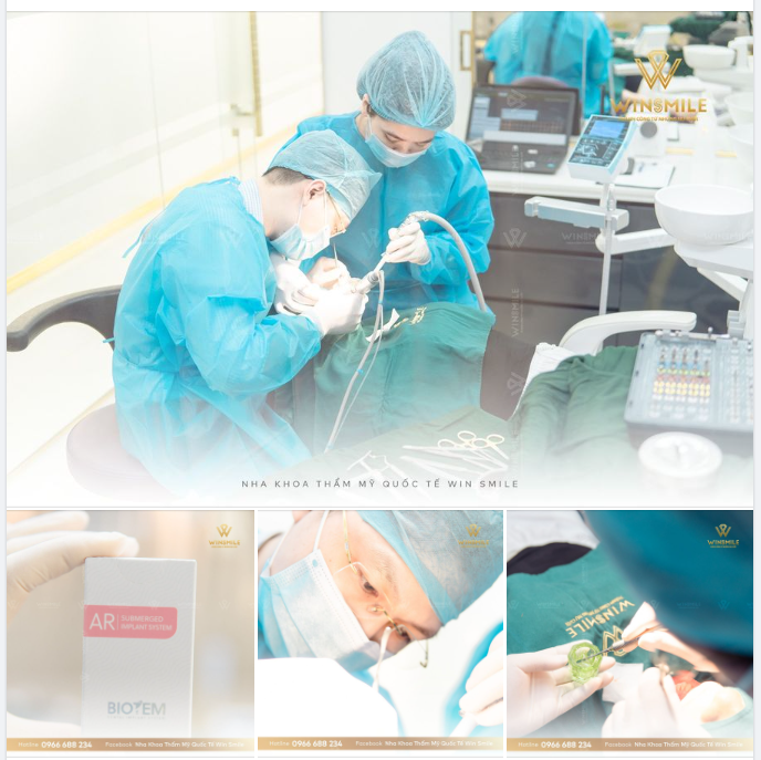 CẤY GHÉP IMPLANT VÀ YẾU TỐ QUYẾT ĐỊNH SỰ THÀNH CÔNG 