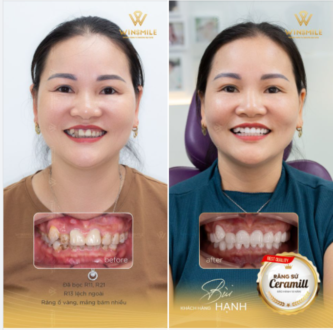 CERAMILL TỎA SÁNG VẺ ĐẸP CÁ TÍNH, TRẺ TRUNG