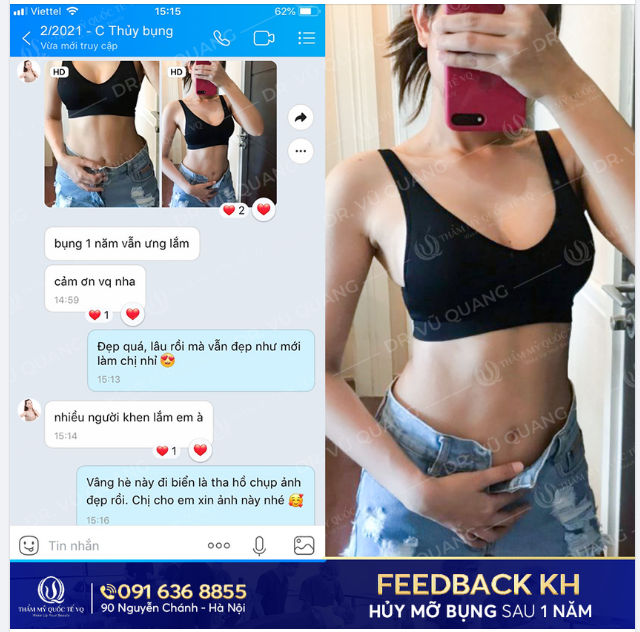 Chào ngày mới với Feedback hủy mỡ vòng 2 Body Jet Extra sau 1 năm thực hiện của Dr Vũ Quang .