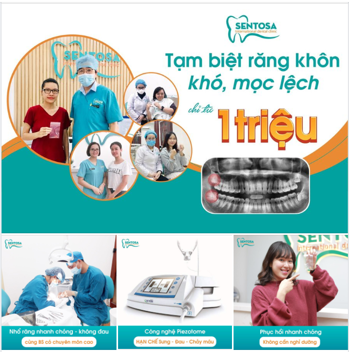 CHỈ 5 PHÚT CHẤM DỨT NỖI ĐAU RĂNG KHÔN VỚI CÔNG NGHỆ PIEZOTOME