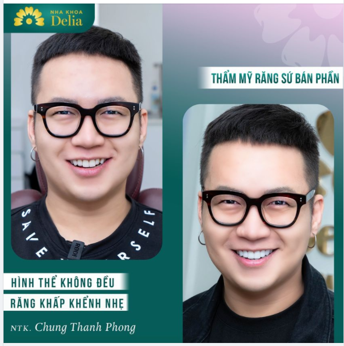 Chỉ sau 48h - Kiến tạo nụ cười mới của riêng NTK Chung Thanh Phong