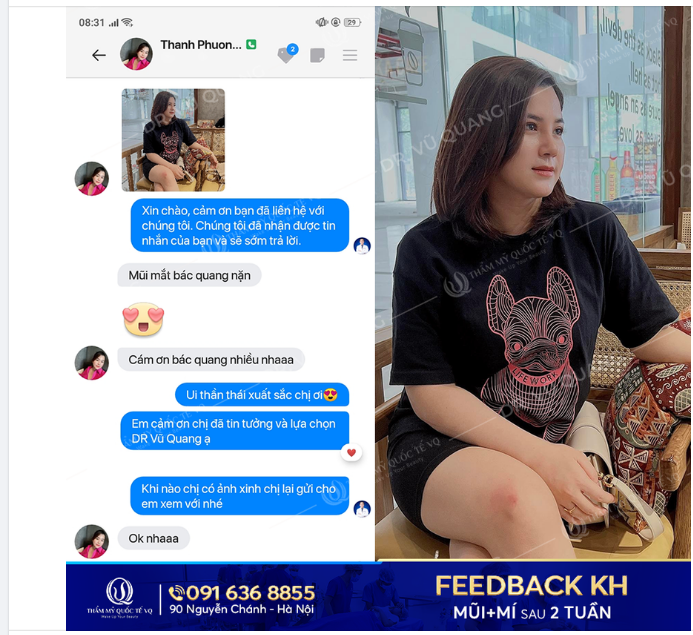 Chị Thanh Phương đẹp không cần son phấn vì combo Mũi Softline + Mí của Dr Vũ Quang đẹp thách thức mọi góc nhìn rồi ạ