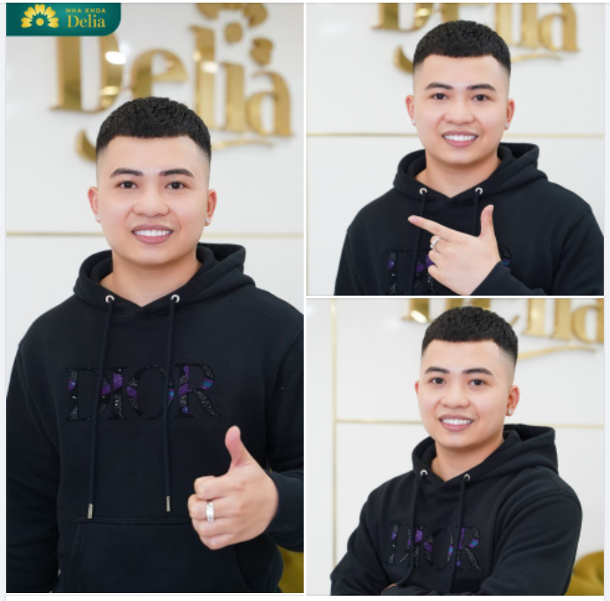 Chia sẻ từ anh Long Vũ (KH thẩm mỹ 20 răng sứ HT Smile)