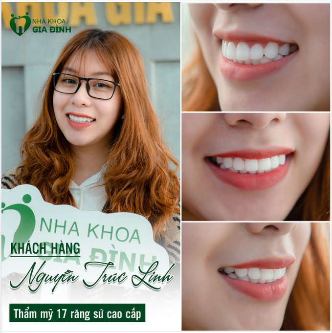 CHỌN NỤ CƯỜI ĐẸP - CHỌN LÀM RĂNG AN TOÀN! CHỈ CÓ THỂ LÀ NHA KHOA GIA ĐÌNH