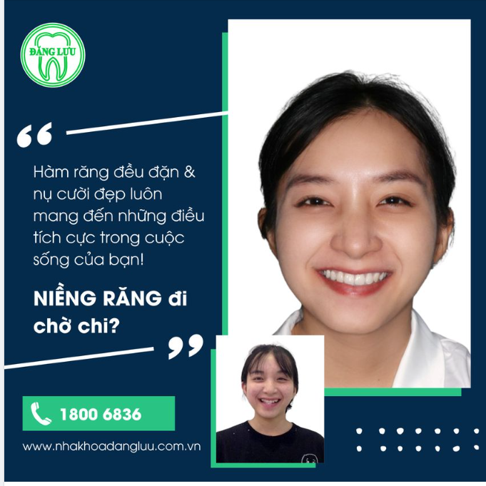 Chúng ta nhất định sẽ vui vẻ hơn khi được thoải mái cười rạng rỡ mà không bị bất kỳ điều gì ngăn cản.