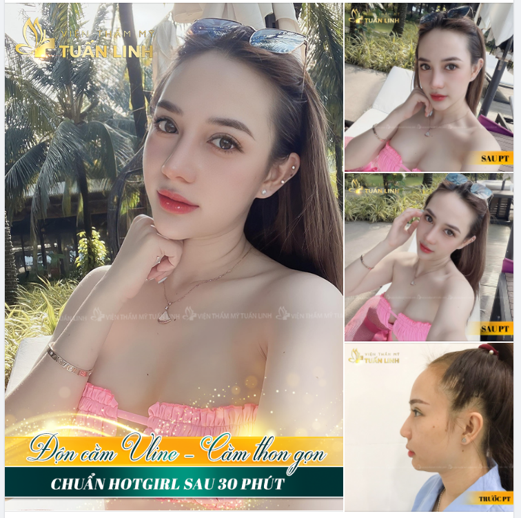 CÔ NÀNG 9X XINH ĐẸP VỚI CHIẾC CẰM VLINE THỜI THƯỢNG