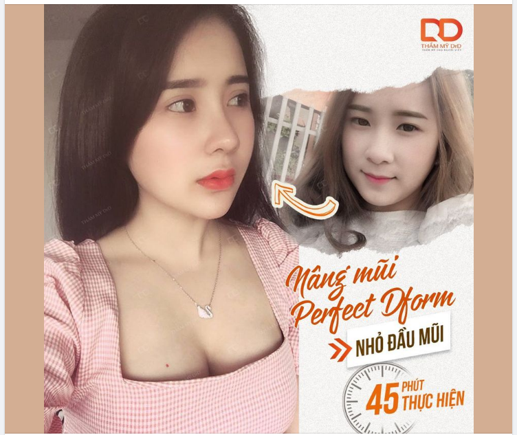 CÓ NÊN CHỈ THU GỌN ĐẦU MŨI MÀ KHÔNG NÂNG SỐNG MŨI KHÔNG