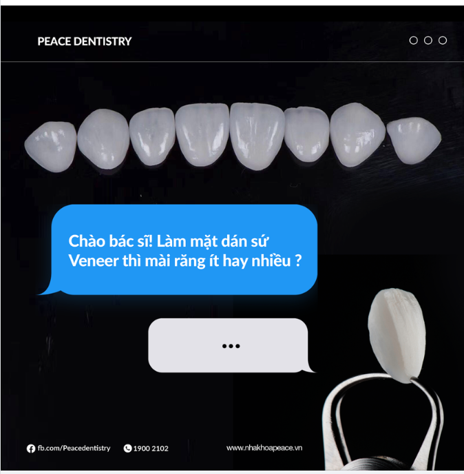 Có thể nói mặt dán sứ Veneer là phương pháp thẩm mỹ răng sứ giúp bạn thiết kế lại nụ cười của mình nhưng vẫn giữ lại gần như trọn vẹn răng thật.