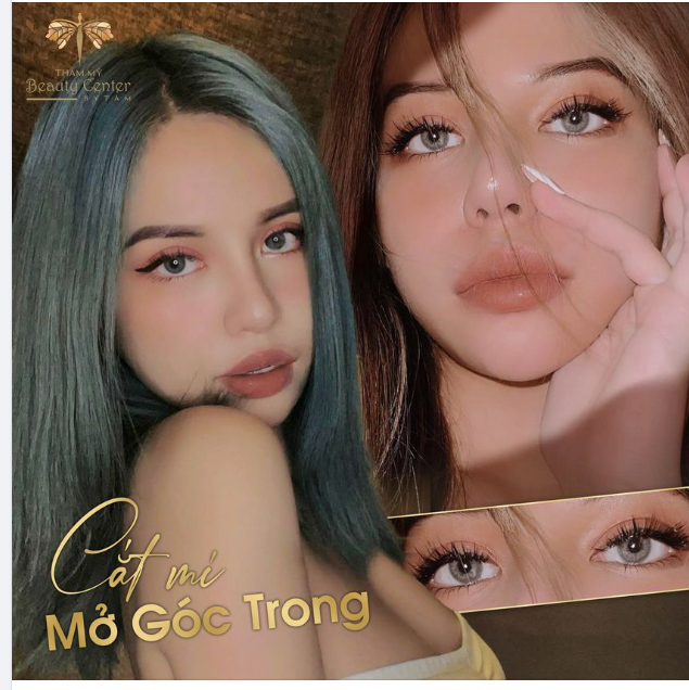 COMBO PERFECT EYES CẮT MÍ + MỞ GÓC MẮT - Mí sụp, mí lót, mắt một mí lờ đờ chỉ còn là dĩ vãng!