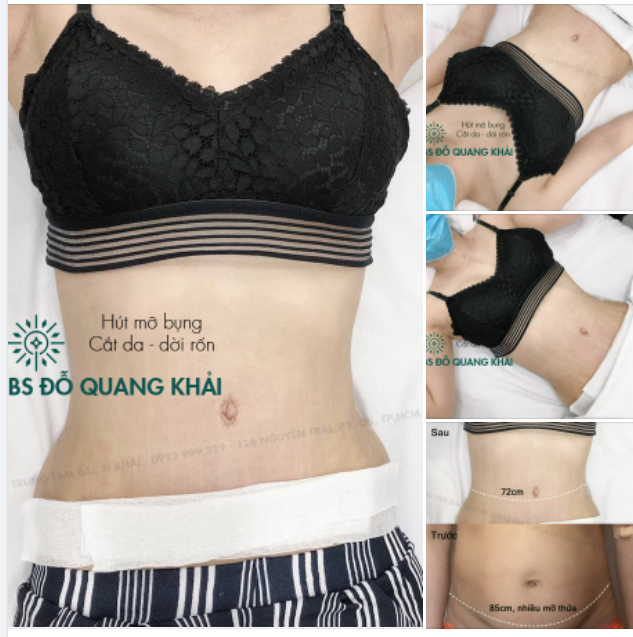 Combo Tạo Hình Vòng 2 Siêu Chất