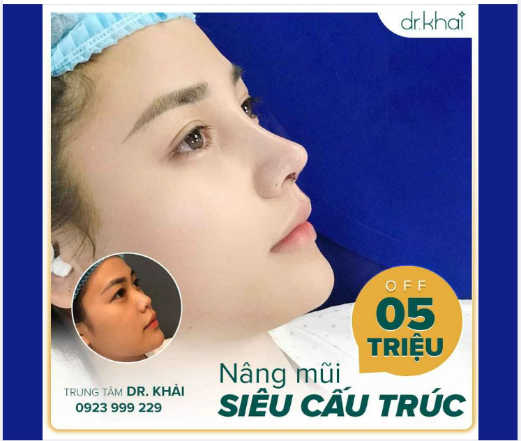 CỰC PHẨM MŨI SIÊU CẤU TRÚC TỰ NHIÊN ƯU ĐÃI HOT TẠI TRUNG TÂM BS KHẢI