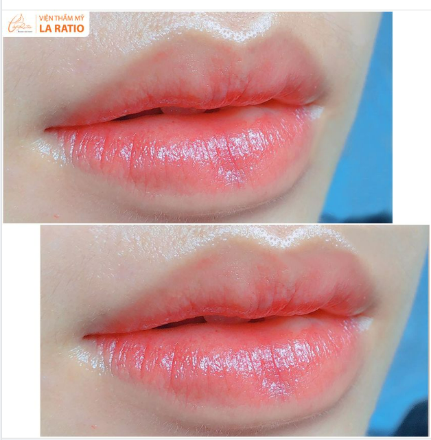 Cũng là  phun môi mà ở La Ratio lại  lạ lắm