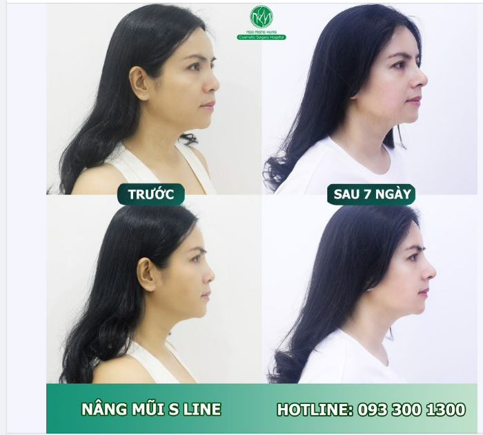 DÁNG MŨI ĐẸP CHO BUỔI SÁNG CUỐI TUẦN