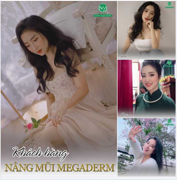 DÁNG MŨI ĐẸP TỰ NHIÊN - AI NHÌN CŨNG THÍCH