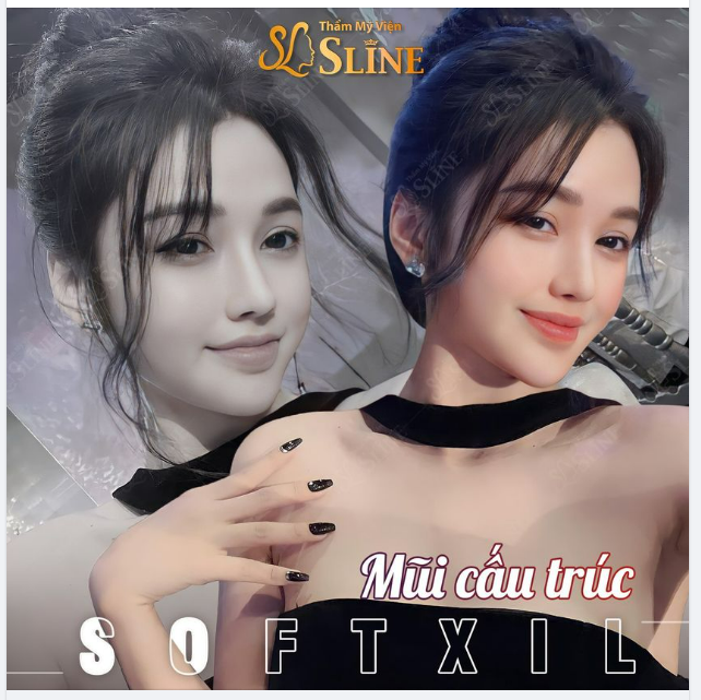 Dáng mũi đốn gục hàng triệu con tim ​​​​​​​.