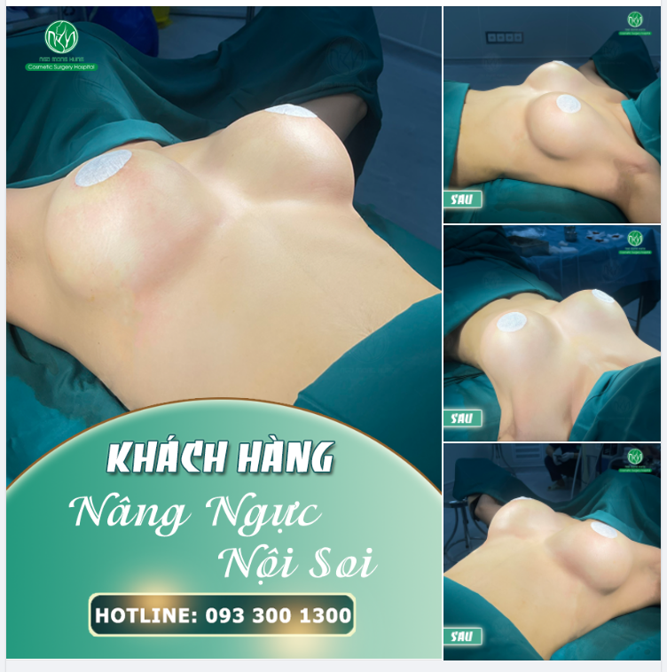 DÀNH CHO CÁC CHỊ EM THÍCH VÒNG 1 GỢI CẢM