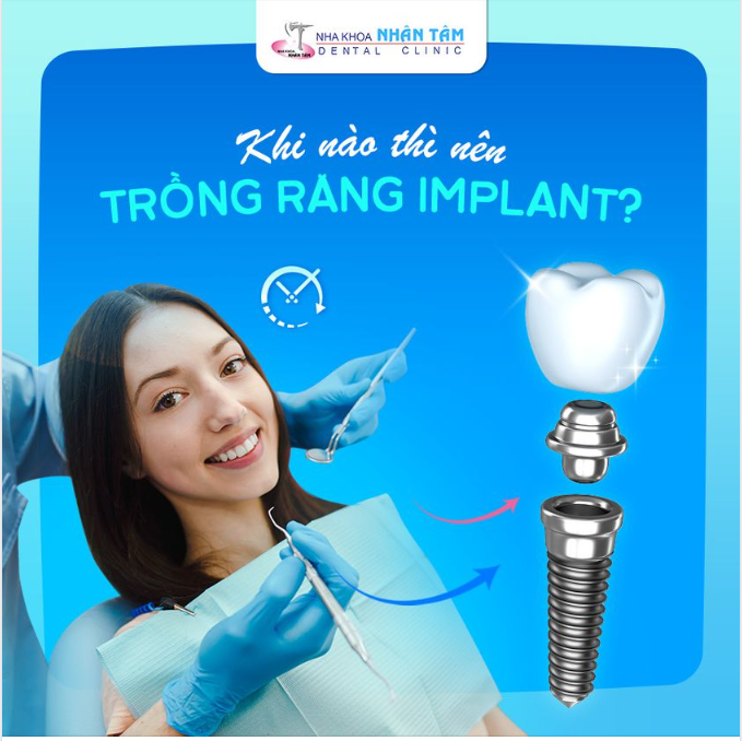 ĐÂU LÀ THỜI ĐIỂM THÍCH HỢP ĐỂ TRỒNG RĂNG IMPLANT?