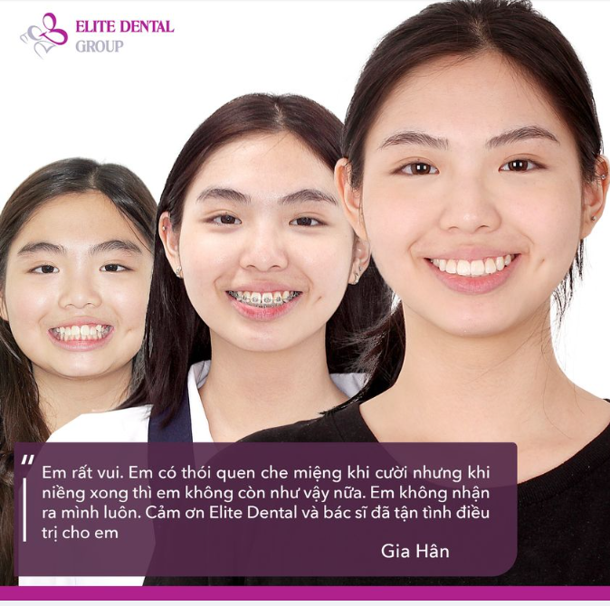 ĐẾN ELITE CHỈNH NHA LÀ DẬY THÌ THÀNH CÔNG