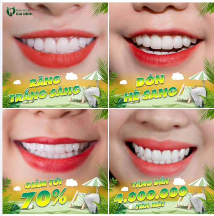 ĐẸP! ĐẸP NỮA! ĐẸP MÃI CÙNG NHA KHOA GIA ĐÌNH