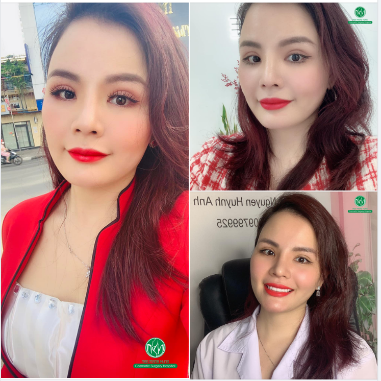 ĐẸP HẾT NẤC SAU THẨM MỸ MẮT