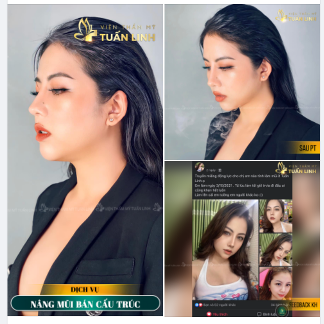 ĐẸP, SANG, QUYẾN RŨ GẤP NGÀN LẦN SAU NÂNG MŨI